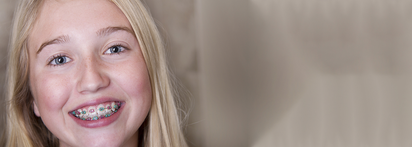 Children's Braces In Swindon Dentalcare Swindon Offer Braces for children